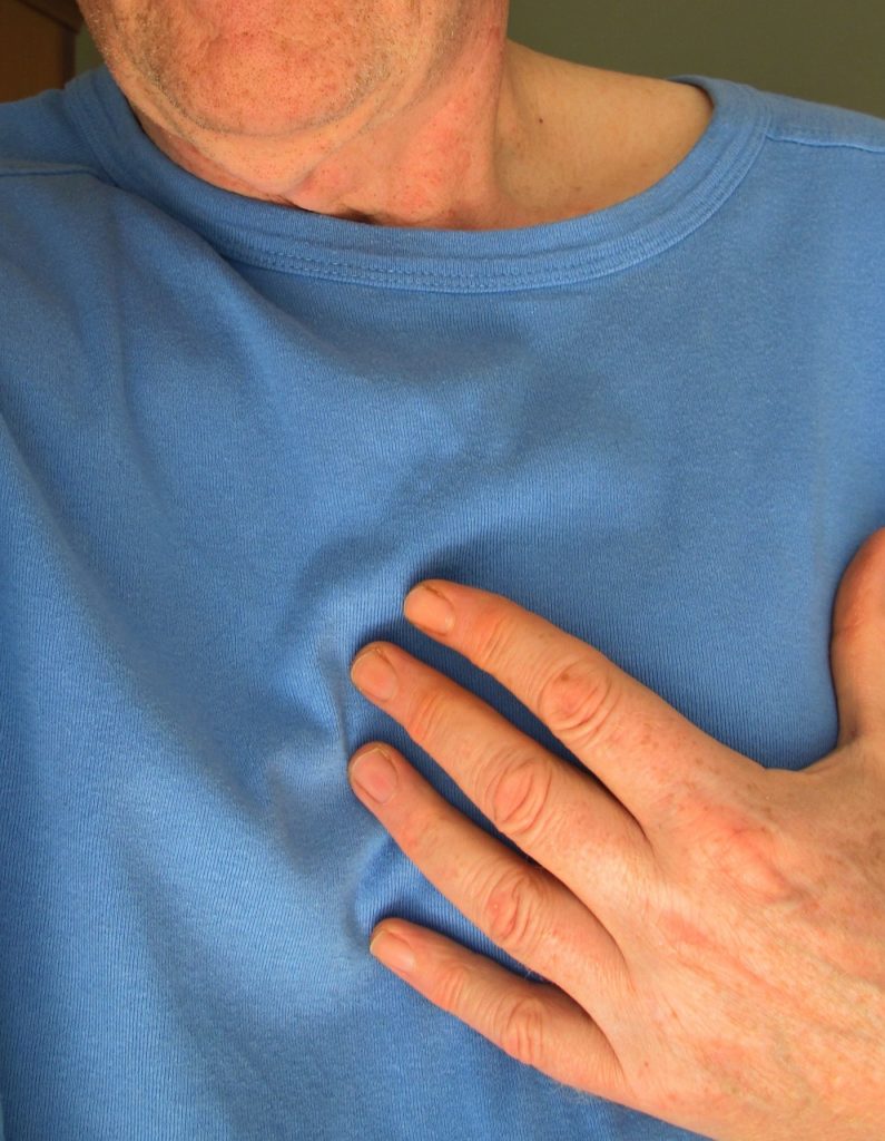 heart-pacemaker