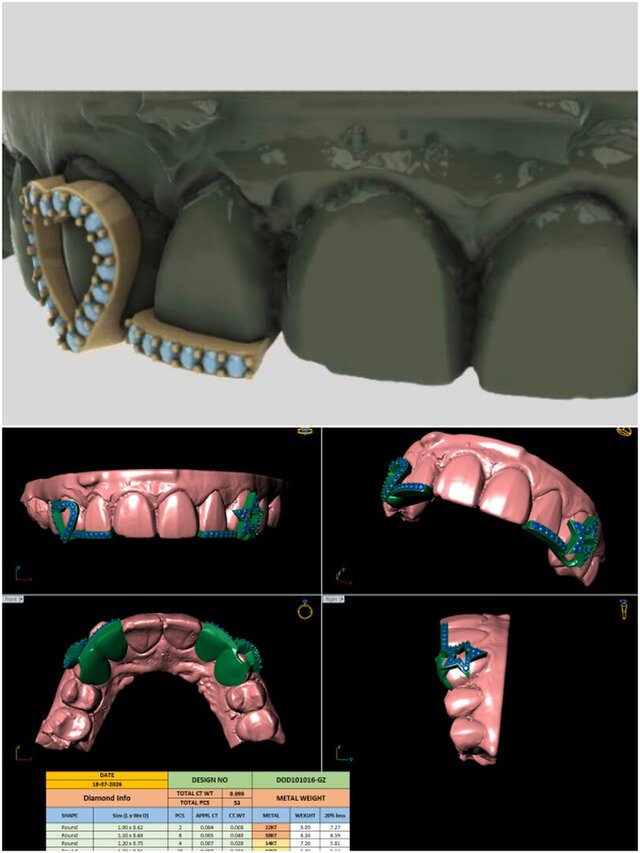 3D model of Grillz