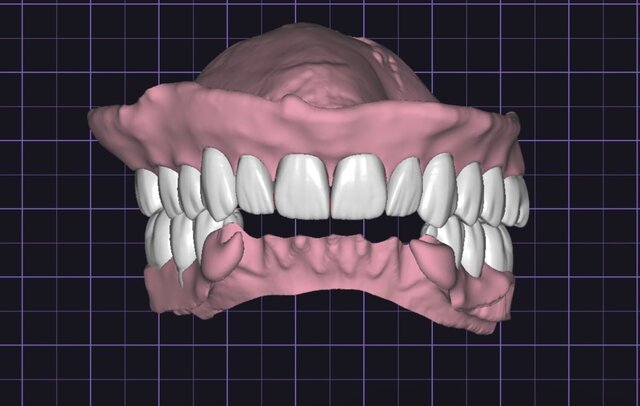 3D model of full-mouth