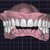 full-mouth