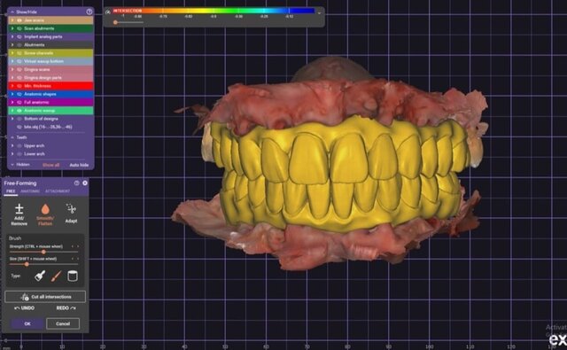 3D model of full-mouth