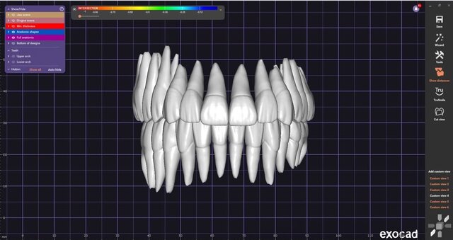 3D model of full-mouth