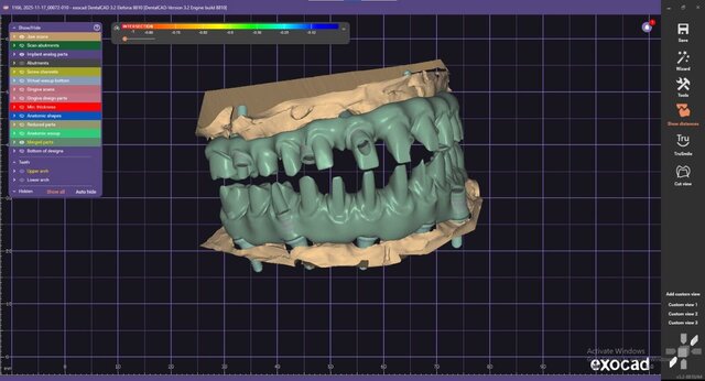 3D model of full-mouth