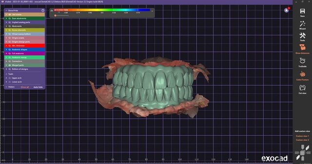 full-mouth