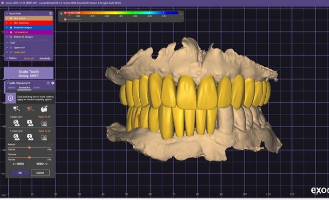 3D model of full-mouth
