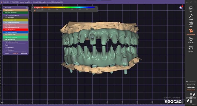 3D model of full-mouth