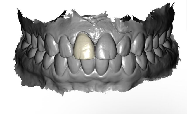 3D model of Crown