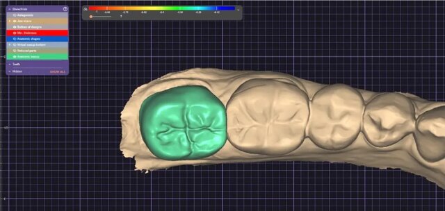 3D model of Crown