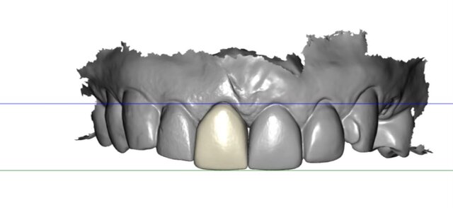 3D model of Crown
