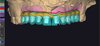 full-arch design by mohamedm6621