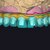 full-arch