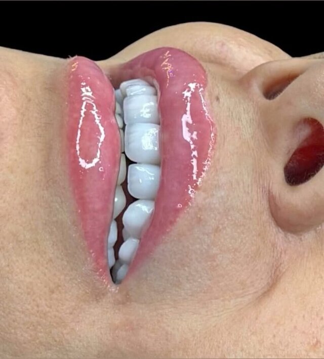 3D model of full-arch