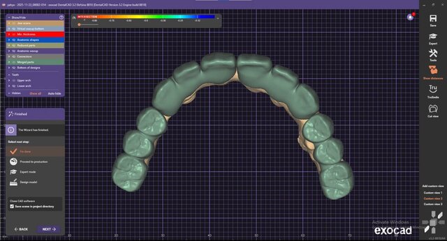 3D model of full-arch
