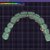 full-arch