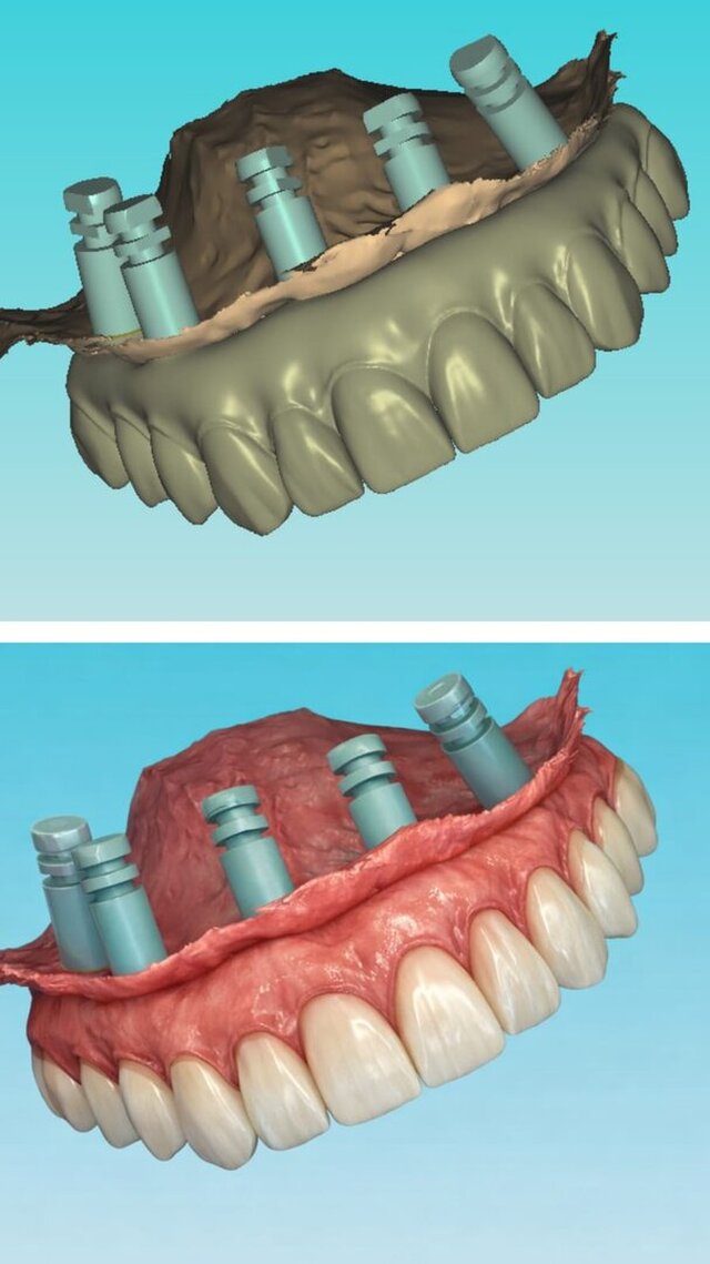 I offer dental cad freelance designing services